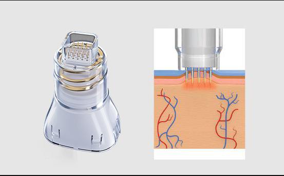 fusion-tip-new-2